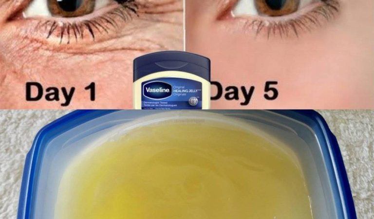 The Power of Vaseline to Remove Wrinkles! Look 20 Years Younger Naturally